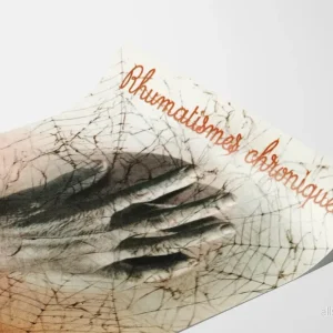 Vintage reklamposter Tiodine för kroniska reumatism - Bild 3